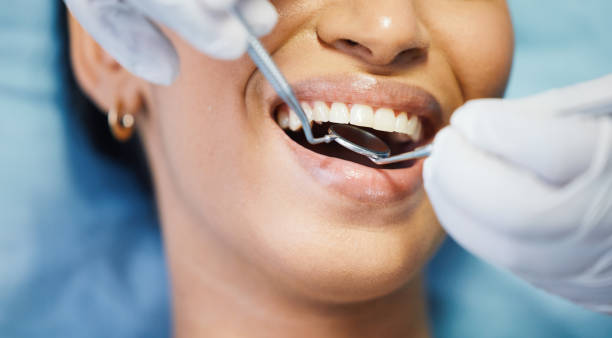 Best Emergency Wisdom Teeth Removal in Chagrin Falls, OH
